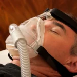 CPAP Masks